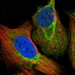 Aldehyde dehydrogenase 5 Antibody, Novus Biologicals:Antibodies:Primary